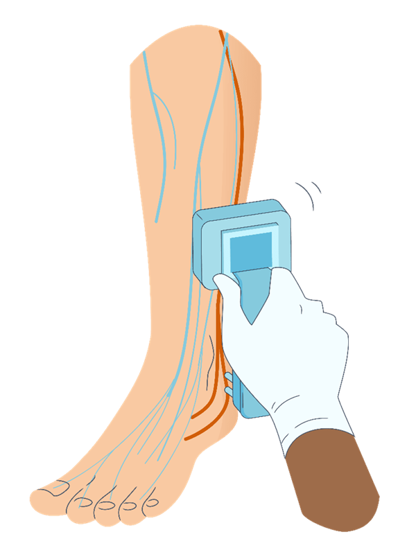DPNCheck simple testing process showing the device and testing procedure